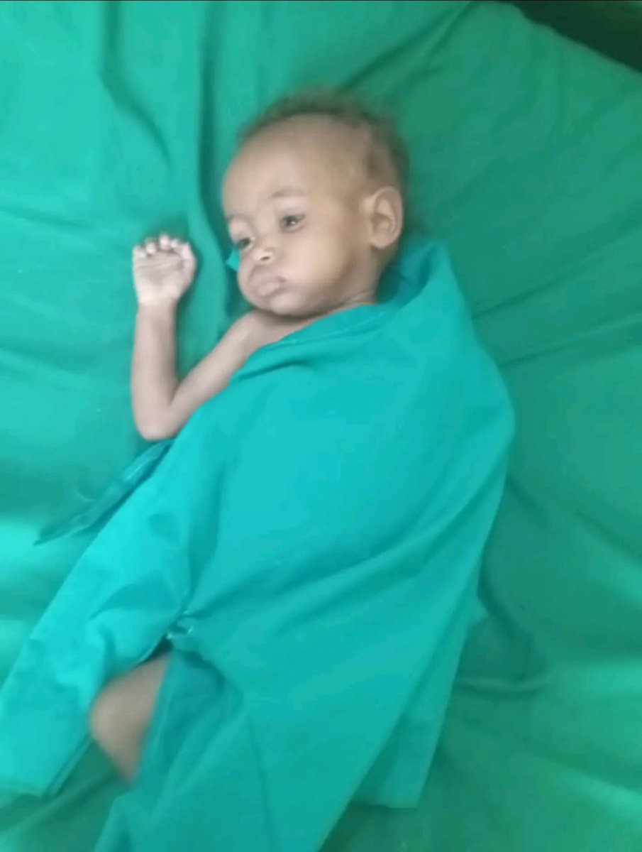 Please read ‼️ I seriously debated with myself whether to post individual cases; but death and famine in Sudan is not humanised like it is in Palestine or Ukraine. Most of the world views Sudanese and African suffering in general as a mere statistic when these Sudanese children