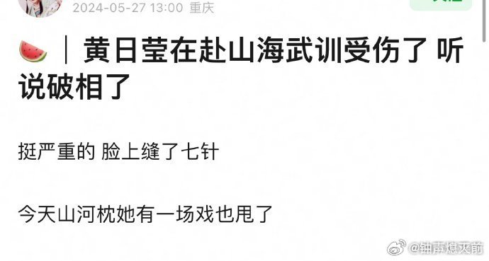 melon_num5's tweet image. After kicking #HuangJunjie off #ChengYi's Fu Shan Hai drama is back under spotlight for an accident that caused another Huanrui artist #HuangRiying to get 7 stitches across her face. Seems that this drama is not off to a smooth start at all.