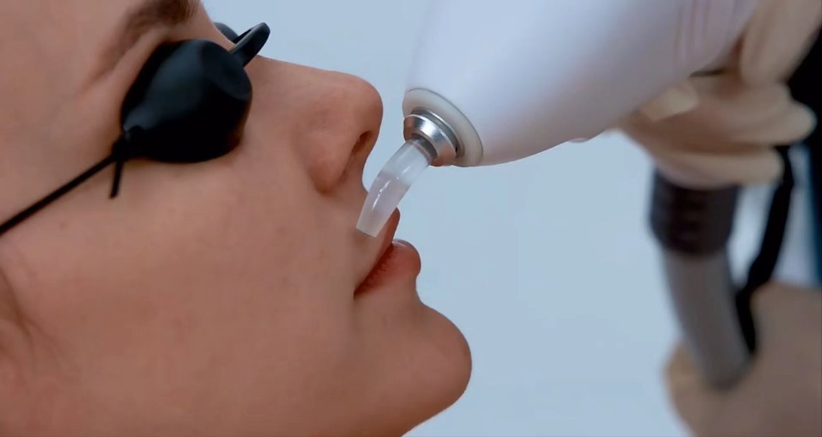 The world‘s first 808nm hair removal device with a nose 👃hair removal handle  

Not only for body hair removal, but also for areas that are usually neglected  

Being a refined person is not just for summer👏🏻👏🏻

#hairremoval #hairremovallaser #nosehair #nosehairremoval
