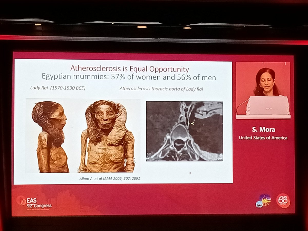 #Egyptians #mummies have been highly informative in telling us that #atherosclerosis is an ancient disease and that it has no sex preferences!
#EASCongress2024
@EASCongress @society_eas
