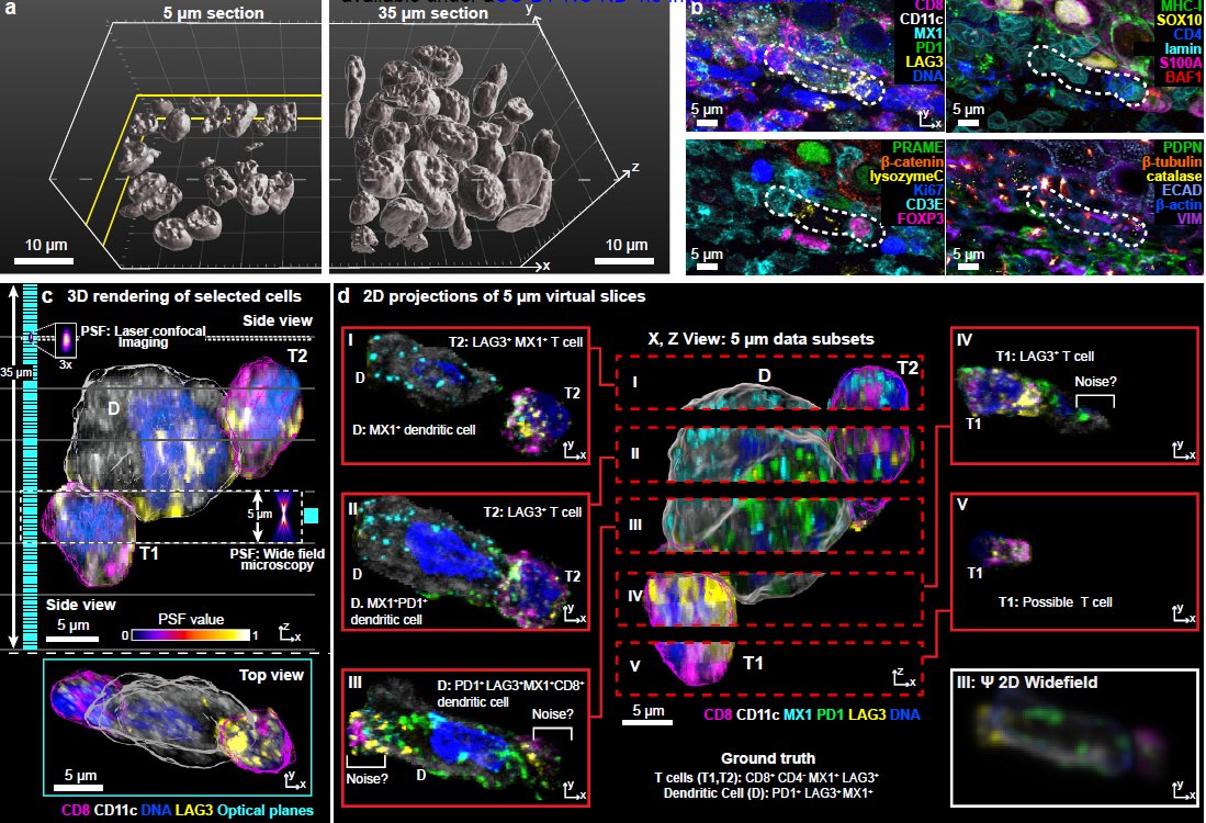 Happy #LearningWednesday! “Multiplexed 3D Analysis of Immune States and Niches in Human Tissue”. A high-res 3D imaging approach that reveals detailed cell interactions and structures in tissue, offering insights into melanoma beyond traditional 2D imaging. shorturl.at/dNdIF