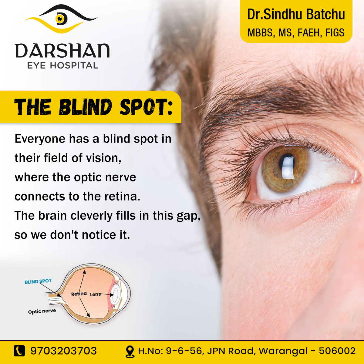 For more interesting topics, please follow Darshan Eye hospitals.

Contact us:970323703

#eyetests #eyehealth #Darshaneyehospital #darshanwarangal #eyecare #infectionfree #eyehealth #glaucoma #cataract