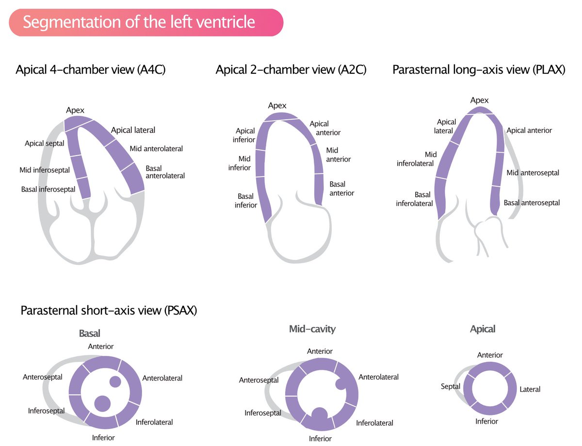 Standardized myocardial segmentation and nomenclature.
#FOAMed #FOAMcc #POCUS #MedEd 
Look at the PSAX first and imagine the plane of apical views. Makes it much easier to comprehend.
Img source:  ecgwaves.com/topic/left-ven…