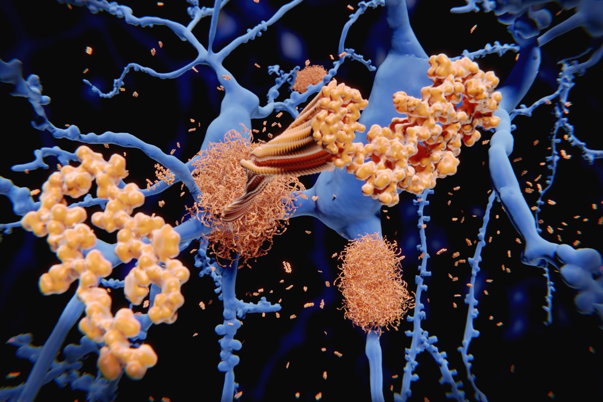 Study finds Plexin-B1 could be key to Alzheimer’s treatment, enhancing glial cell response 🧠🔬🧪 news-medical.net/news/20240529/… #Alzheimers #PlexinB1 #Neuroscience #Brain #Health #AmyloidPlaques #GlialCells#Neuroinflammation #SynapticFunction #Memory @NatureNeuro