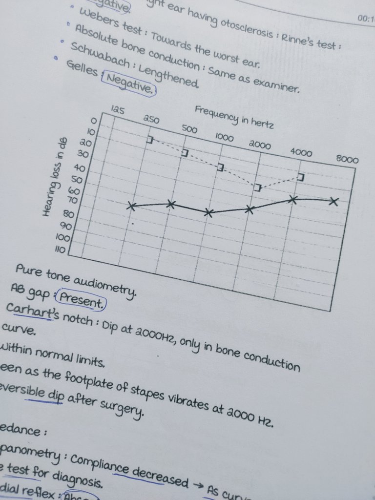 Carhart's notch (otosclerosis):
Dip at 2000 Hz.