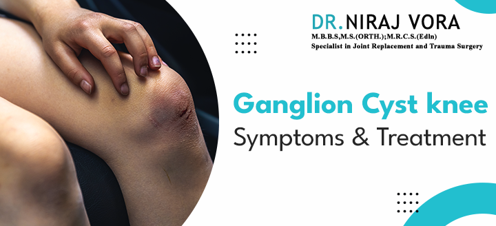 #GanglionCystKneeSymptoms and Treatment | #DrNirajVora Many of us have likely encountered a small, oval-shaped bump on our hands or knees. These cysts, known as ganglion cysts, come in varying sizes, filled with a thick, spongy substance.. Know more at: drnirajvora.com/blog/ganglion-…