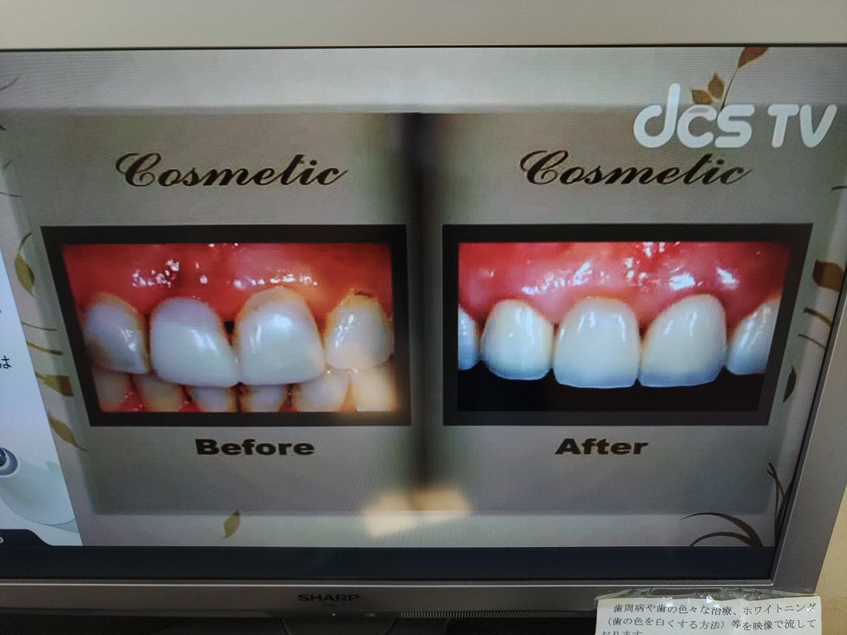 KTM819O4's tweet image. #歯科健診 #DCSTV