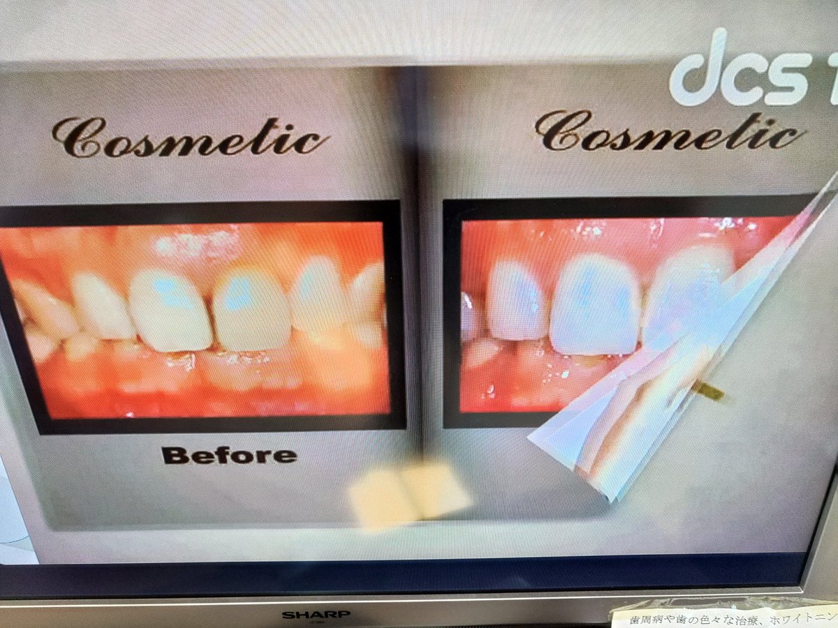 KTM819O4's tweet image. #歯科健診 #DCSTV