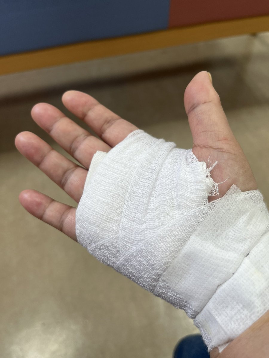 ムチムチのお手手🖐で失礼

バネ指の手術してきた。
意識ある中での手術って初めてだったのでめっちゃ怖かった。
麻酔切れかけてきて痛い😭