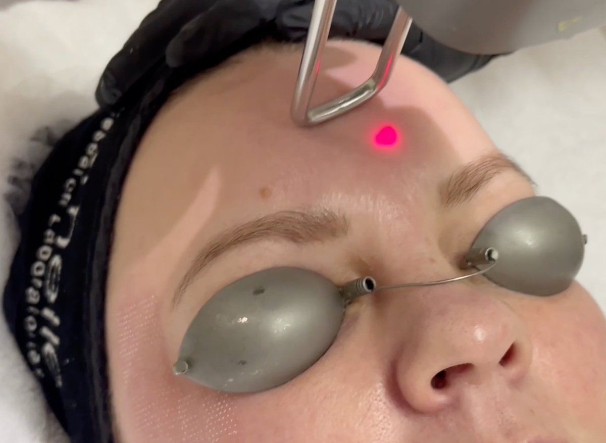 SkinBodyRenewal's tweet photo. Transform Your Skin with Our New Signature Solution: Fractional Fusion #2! & address fine lines, pigmentation, and skin texture, for a radiant and youthful complexion https://t.co/k8QIPpYqh4
#SkinRenewalSA #FractionalFusion #AdvancedSkincare #YouthfulGlow #RadiantSkin https://t.co/LpdBIMM48D