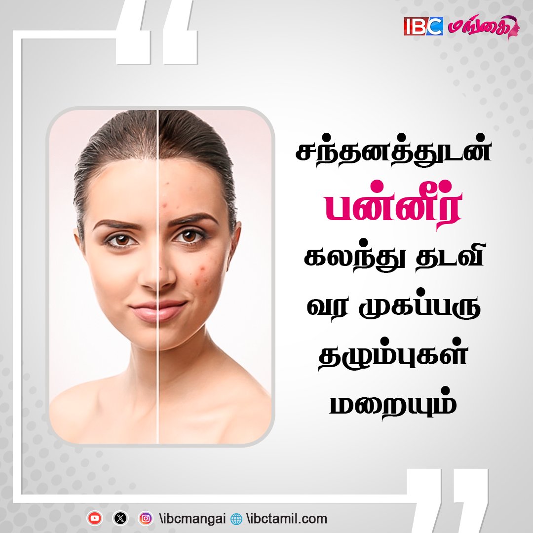 IbcMangai's tweet image. Home remedy to remove Acne Scars | Skin Care

#acne #acnescars #pimples #skincare #ibcmangai