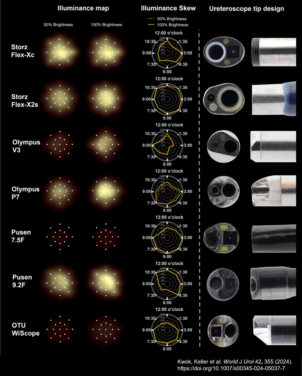 Illumination matters in fURS
💡Comparisons of light sources
🔍Aspects never evaluated before!
📔4 part <a href="/wjurol/">World Journal of Urology</a> collection
🧑‍🤝‍🧑Fantastic collaboration
👇Open access links (I-IV)
I: doi.org/10.1007/s00345…
II: doi.org/10.1007/s00345…
III: doi.org/10.1007/s00345…
IV: