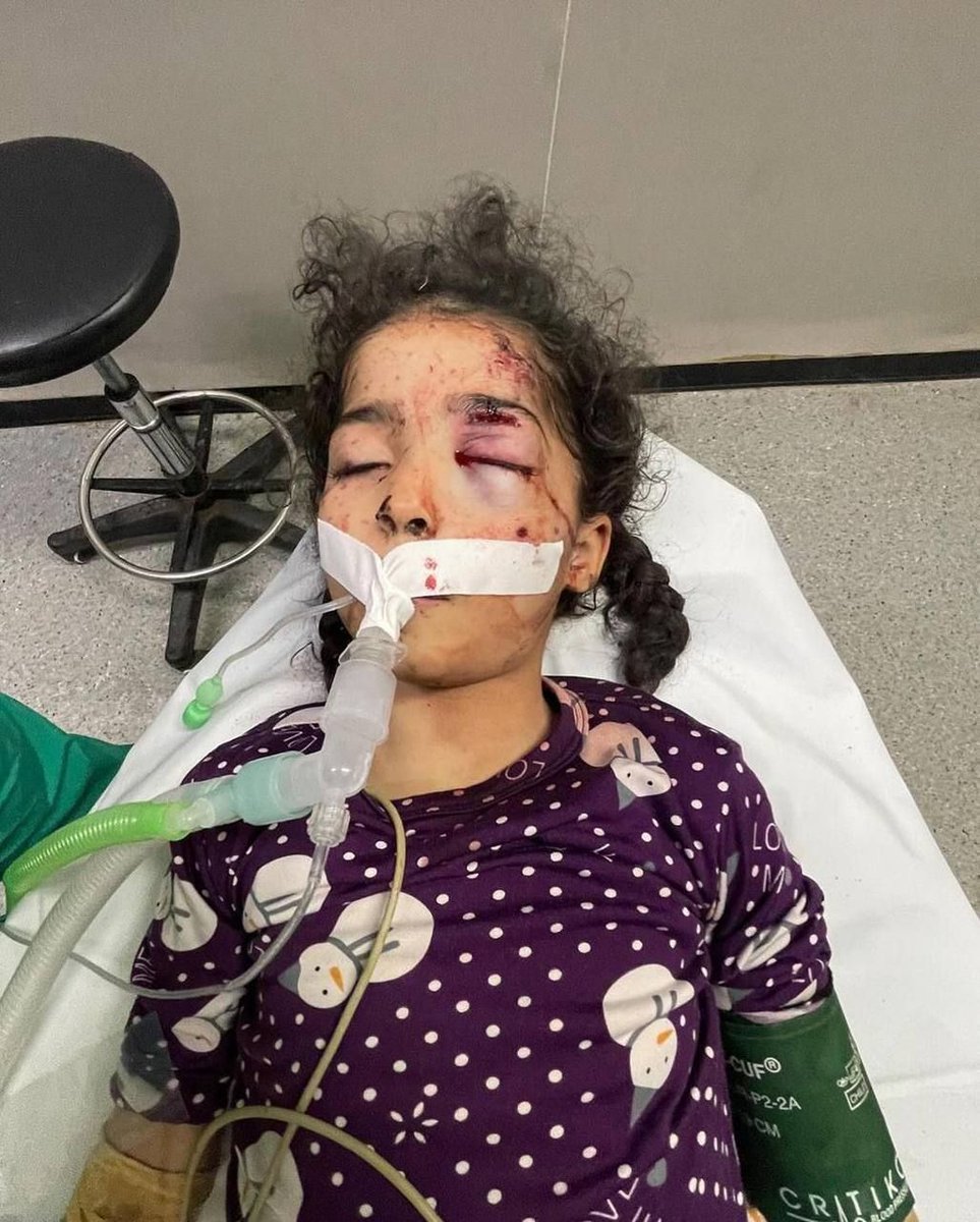 Timesofgaza's tweet photo. Day 235 | During the past 24 hours:

• 6 massacres committed by the Israeli occupation

• 75 people killed 

• 284 injured

15 people killed in combined lsraeli aerial and artillery bombardment since dawn in Rafah https://t.co/ZdhhGgF0pi