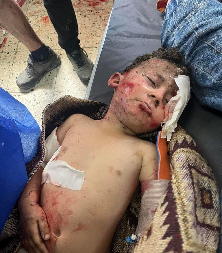 Timesofgaza's tweet photo. Day 235 | During the past 24 hours:

• 6 massacres committed by the Israeli occupation

• 75 people killed 

• 284 injured

15 people killed in combined lsraeli aerial and artillery bombardment since dawn in Rafah https://t.co/ZdhhGgF0pi