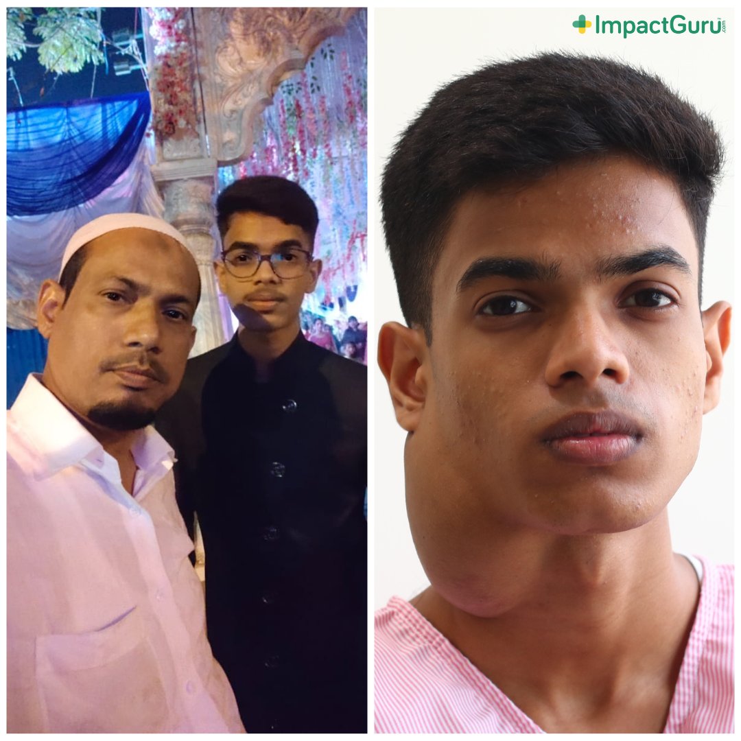 Two years ago, Sayyed’s life took a drastic turn when he was diagnosed with a cystic lesion near his neck. The only way to ensure Sayyed’s health and future is through a costly surgery that the family cannot afford. Please help: impactguru.com/s/1Nja2i #Fundraising #DoGood