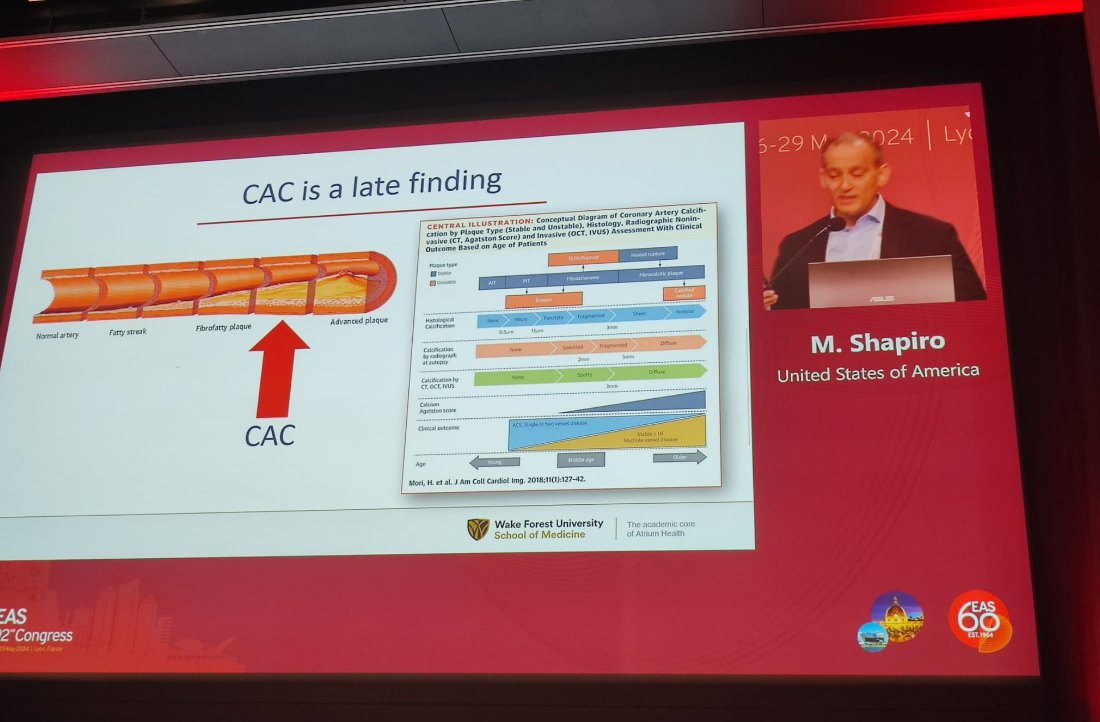 Focusing on preventing atherosclerosis, rather than MI, is a more effective approach for patient management. The disease is #ath not heart attack, and CAC is a late finding❗️For this reason, it does not fit the classic definition of primary prevention
#EASCongress2024 #MyEAS2024