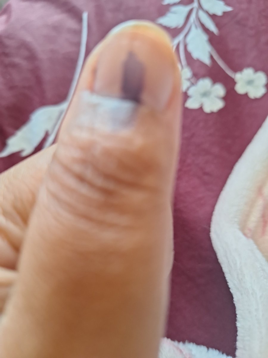 Janet Baron tweet media