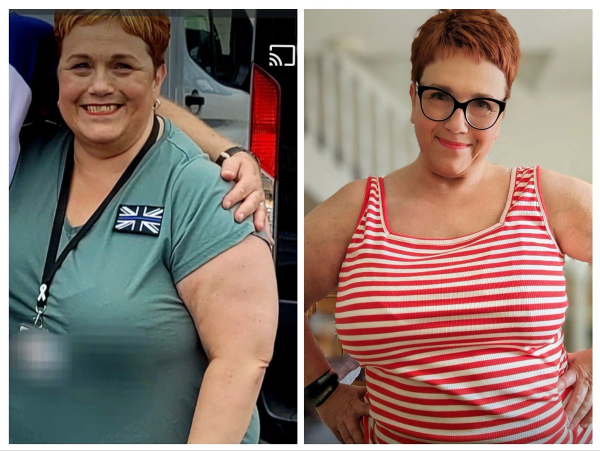 So yesterday I posted a photo of my weight loss, I've been asked for a before photo so here is me last year on the left before starting <a href="/SlimmingWorld/">Slimming World</a> in December 2023 - thank you all so much for your encouragement and ongoing support. Still a few stone to go but I'll do it