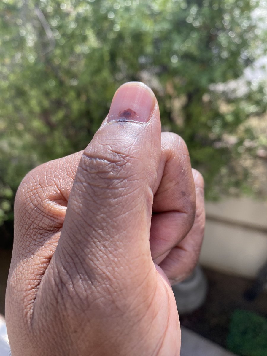 The situation at my voting station. Long queue but voting is too important for us not to show up. Your vote will likely be the one that matters. | #Saelection2024 #ElectionDay #GoVote #ivoted