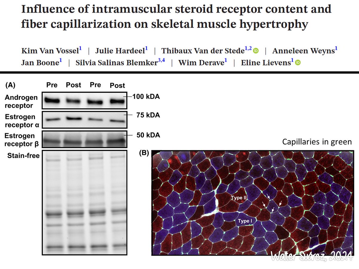 INFLUENCIA DE LOS RECEPTOR DE ESTEROIDES INTRAMUSCULARES Y LA CAPILARIZACIÓN EN LA HIPERTROFIA MUSCULAR ESQUELÉTICA ¡¡¡A leer, zagales!!! drive.google.com/file/d/1isDl5m…