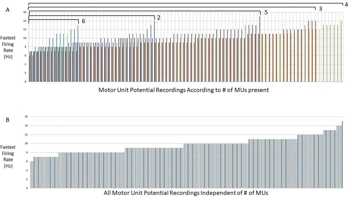 [Motor unit (#MU) recruitment during needle EMG] Rubin and Lamb: 'The determination of reference values for fastest MU firing rates can help to identify mild reduction in recruitment with more accuracy.' doi.org/10.1016/j.clin…