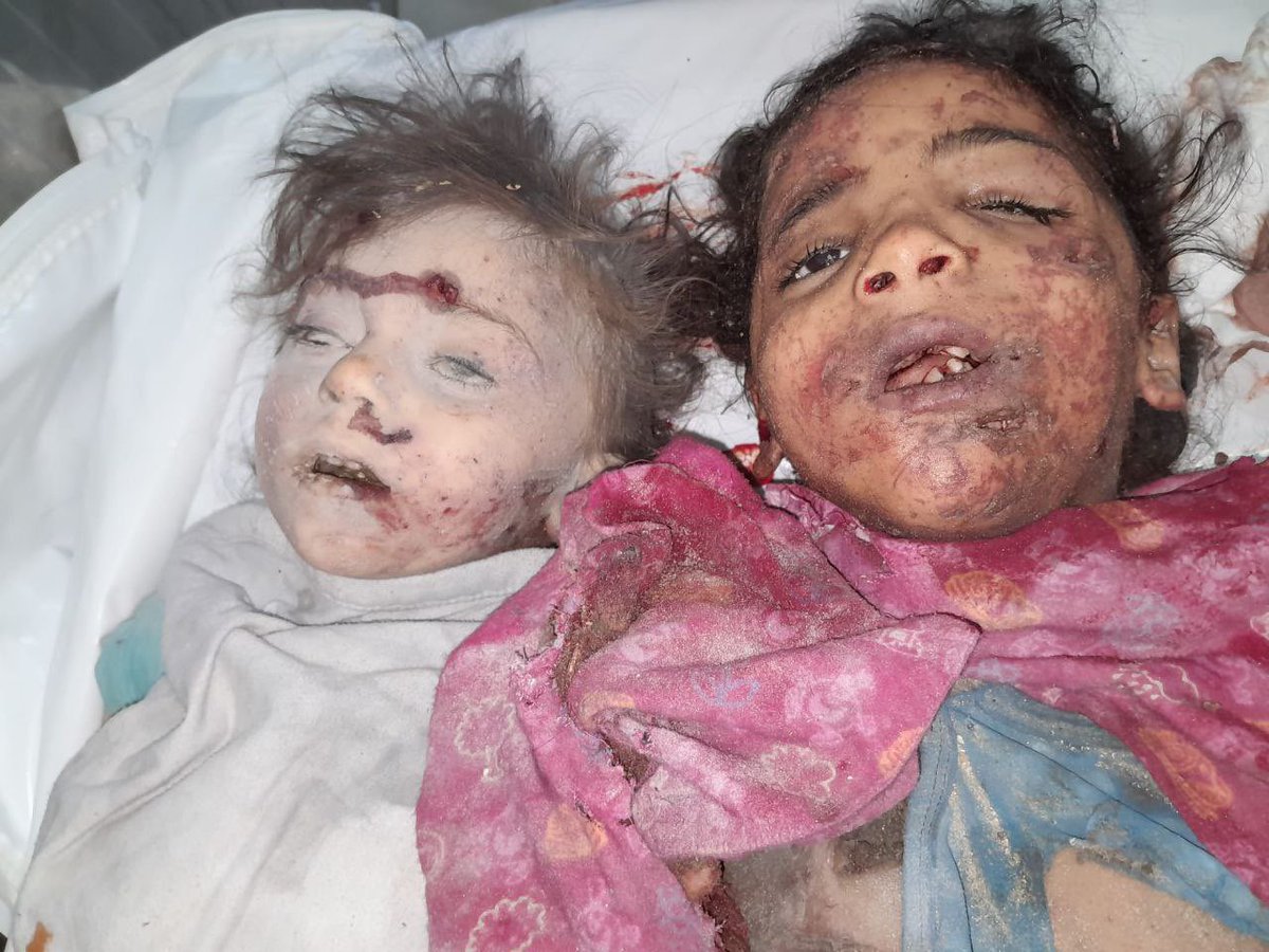 Az önce Gazze.. 

Çocuklara karşı bir katliam daha..