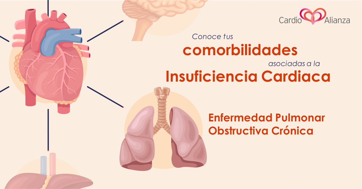 ¿Sabías que la #IC puede causar, o ser causada por, E.P.O.C.? Estas condiciones se llaman #comorbilidades. Si vives con IC, monitoriza tus pulmones🫁

Para obtener más información, dirígete al nuestro canal de YouTube, CardioTV:  youtube.com/watch?v=Yj-O5W…

#ComorbilidadesIC #MesIC