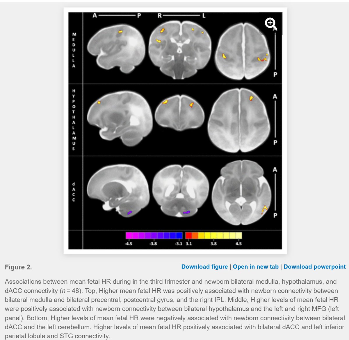 The neonatal brain is so pretty
doi.org/10.1523/JNEURO…