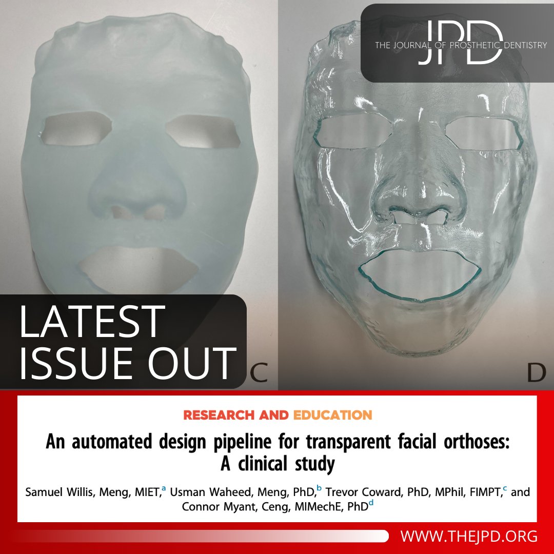 JPDentistry's tweet image. The latest issue of #theJPD highlights this article that compares different #digitalworkflows using various types of #3dfacialscans, #CAD, and #3dprinting approaches and the quality of the resulting prostheses: thejpd.org/article/S0022-…