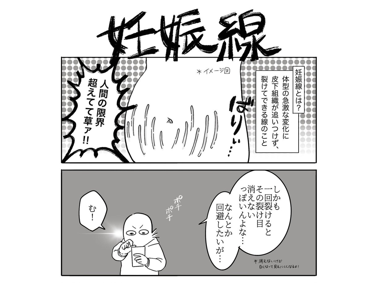 妊娠時の症状って理不尽じゃない?妊娠線編(5/9) 