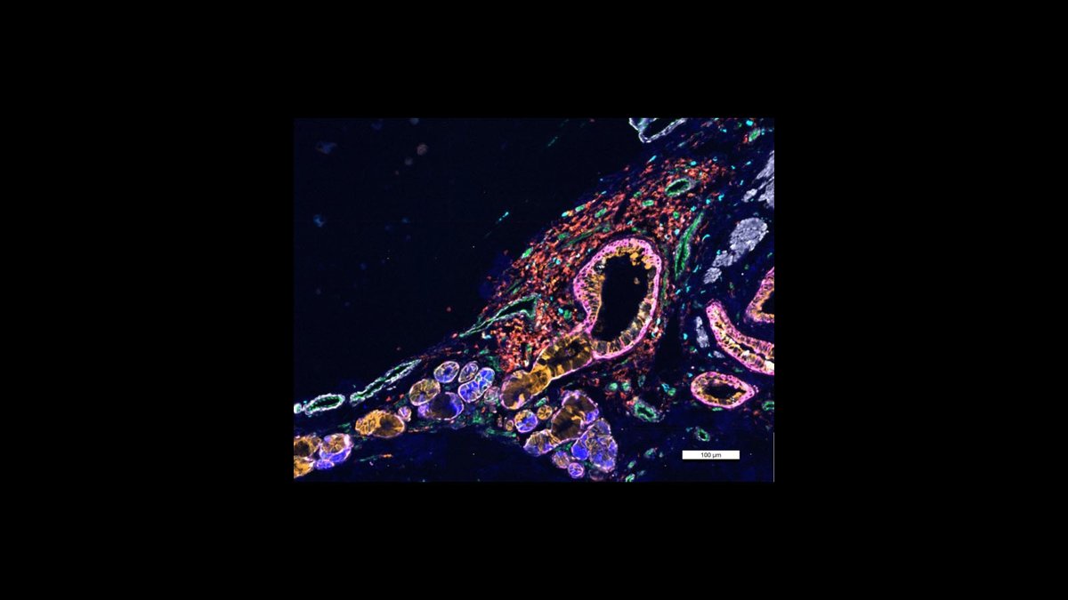 Have you been feeling a bit air-ritated? Then take a deep breath and enjoy this breathtaking #CellDIVE image of a healthy lung from #_hubmap researcher Dr. Gloria Pryhuber @URMC. Just remember – don’t hate, ventilate! #womeninscience #CysticFibrosis Awareness Month