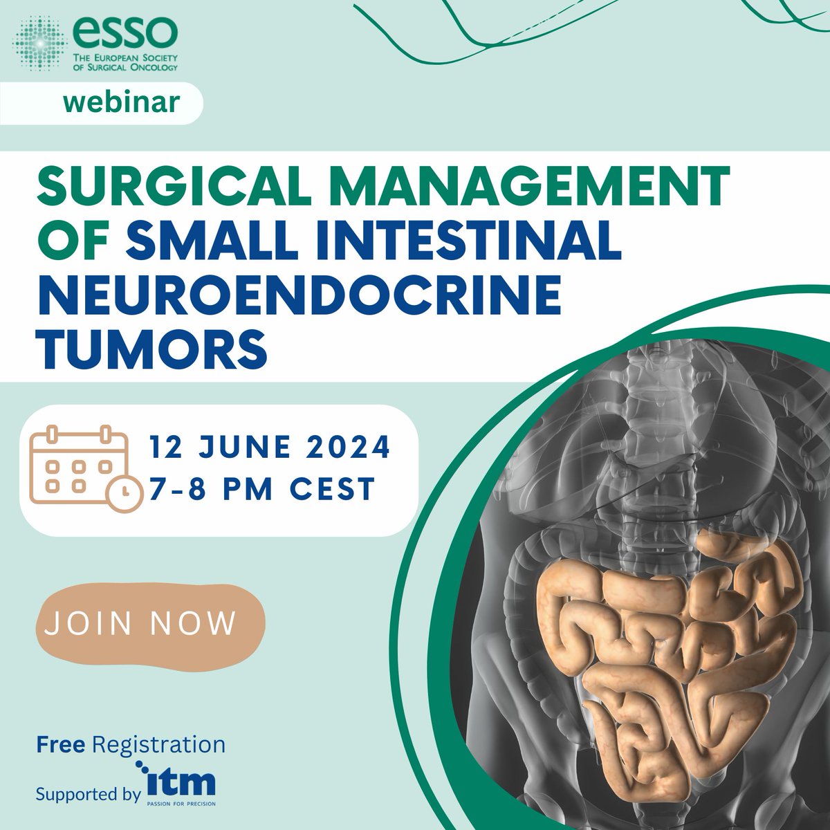 📣 Join us on 📅 June 12 for an insightful discussion on the #surgical management of small intestinal #NET. Gain valuable insights from experts in the field. Register today! 👉 buff.ly/4aCxcF3 #SurgicalOncology @EYSAC1 @SStattner @spartelli @HalletJulie @simonag56739514