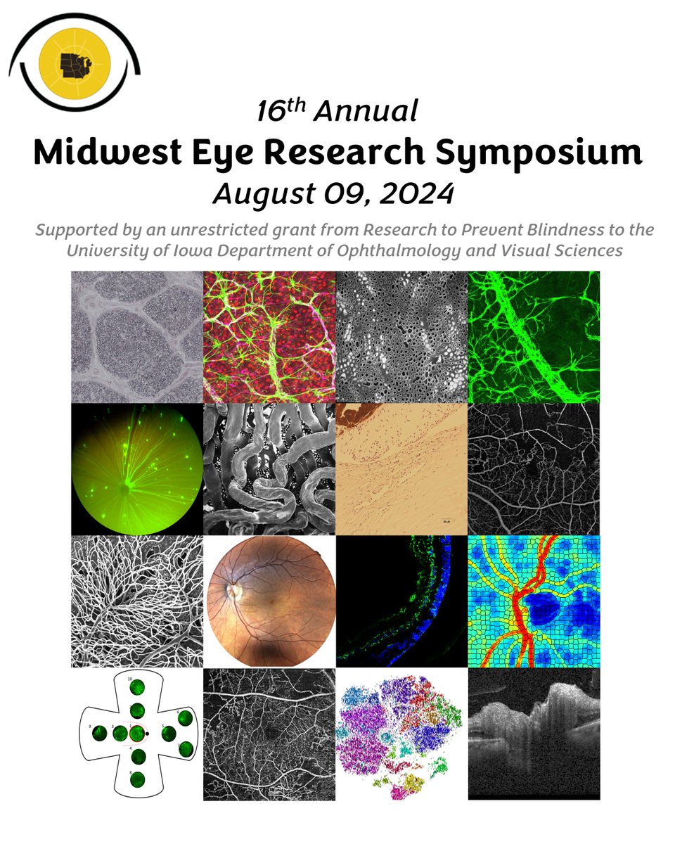 Exciting news! 🤩 The 16th MERS is on August 9th, 2024 at Iowa @uiowaeye ! 

🌟Keynote by Dr. Leonard Levin;  Platform sessions by Drs. Machelle Pardue, Elizabeth Berger, and Elliott Sohn @ElliottSohnMD. 

Info: shorturl.at/bpH5I

#MERS2024 #Ophthalmology #EyeResearch