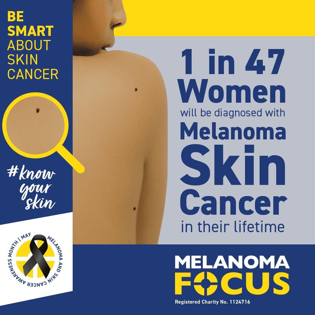 This #MelanomaAwarenessMonth @focusonmelanoma is urging you to #KnowYourSkin: Check your skin and contact your GP if you notice new or changing moles or lesions. Protect your skin from the sun with SPF30+ sunscreen & avoid sunbeds.