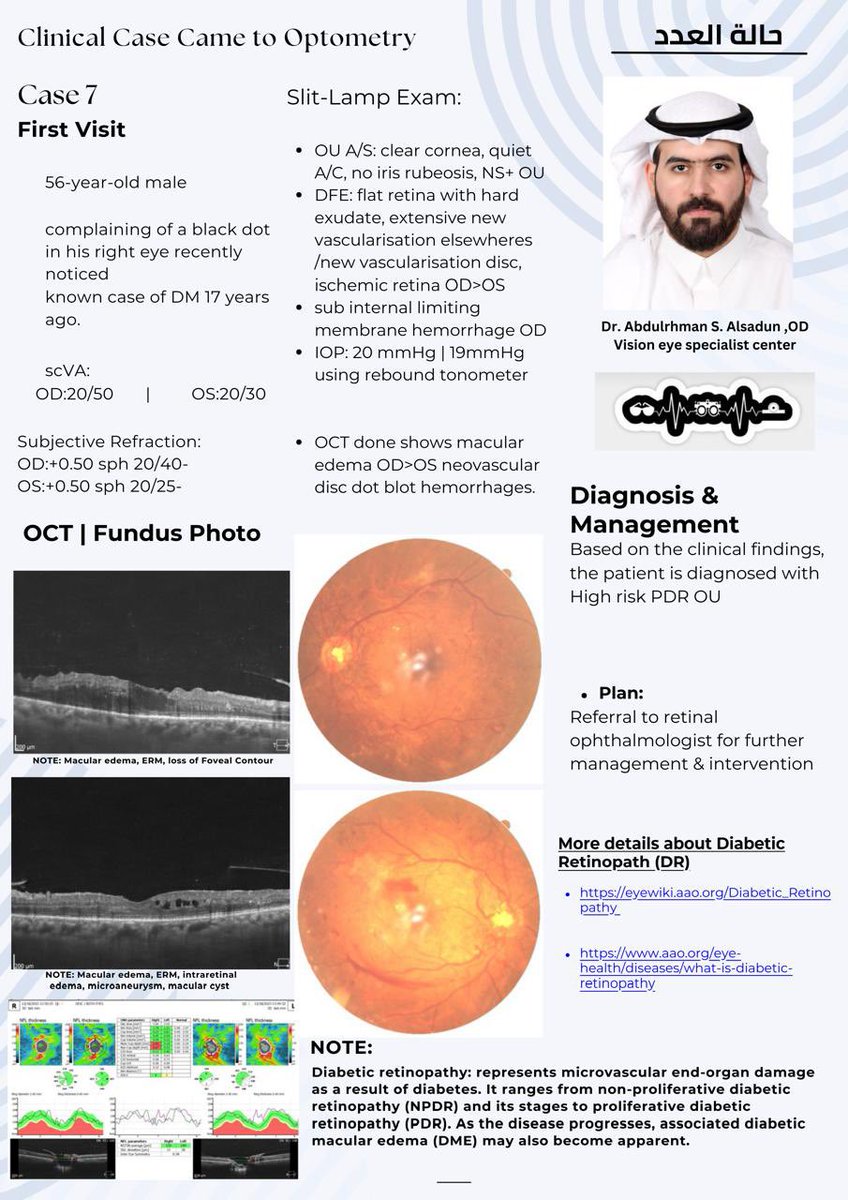 حالة العدد السابع 
يفصل لنا في هذه الحالة دكتور البصريات عبدالرحمن السعدون @ODAB_1 اكتشافه حالة
Diabetic retinopathy 
ونترك لكم متعة قراءة الحالة بشكلي تفصيلي وموسع 
وكيفية التعامل معها ومعلومات عن هذا المرض بشكل مفصل