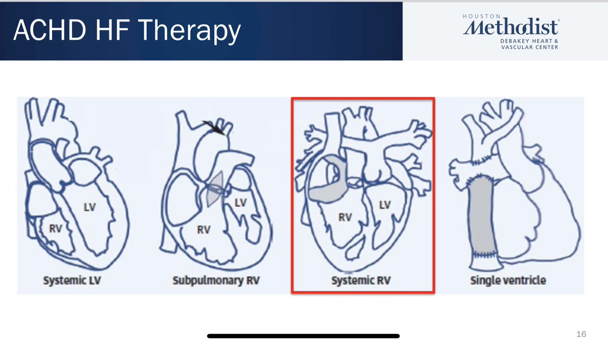 Daniel Marcos Gonzalez MD (@danielmarcosmd) on Twitter photo <a href="/CindyMMartinMD/">Cindy M. Martin</a> breaking down the treatment of heart failure in ACHD patients. Making this complicated topic super digestible at <a href="/UMN_CCCEdSummit/">UMN Critical Care Cardiology Education Summit</a> #CCCES24 <a href="/CindyMMartinMD/">Cindy M. Martin</a> breaking down the treatment of heart failure in ACHD patients. Making this complicated topic super digestible at <a href="/UMN_CCCEdSummit/">UMN Critical Care Cardiology Education Summit</a> #CCCES24