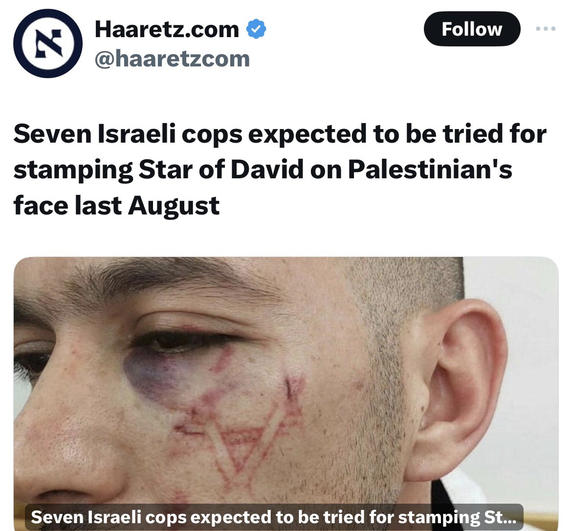 Seven soldiers burnt a star of David in a Palestinian face This was before October 7th in an area where Hamas doesn't exist They Have to choose between living as slaves or raising an armed resistance Which would you choose?