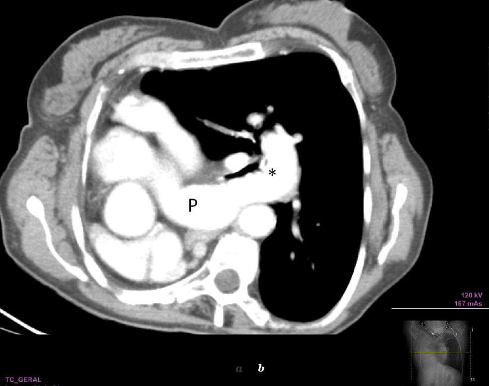 #Spot_diagnosis

What is the Diagnosis?
Other DD??

#MedEd 
#MEDHM 
#MedX 
@IhabFathiSulima