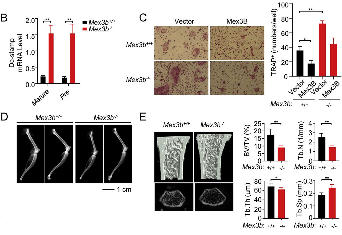 In this study, the authors demonstrate that Mex3B inhibits osteoclast fusion protein DC-STAMP expression and osteoclastogenesis. 

Mex3B inhibits DC-STAMP mRNA level and osteoclastogenesis by Yan Yang, Su-Yun Wang, Zhen-Qi Li, Huang-Ning Wu

Read now
spkl.io/60164N7bG