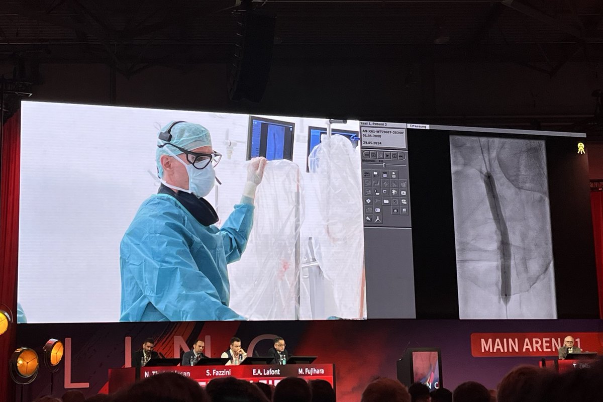 ShockwaveIVL's tweet photo. #ShockwaveIVL was in the spotlight today at #LINC 2024! We started the day with an educational live case from Leipzig performed by Dr Andrej Schmidt who treated a heavily calcified SFA with #ShockwaveM5plus achieving an optimal result. The case was followed by two insightful presentations by Dr Enrique Alejandre Lafont and Dr Narayanan Thulasidasan who showed how #IVL can decrease bailout stenting rate in the fem-pop segment.
US Rx only. ISI https://t.co/x46wohk9Gd @LINCmeeting