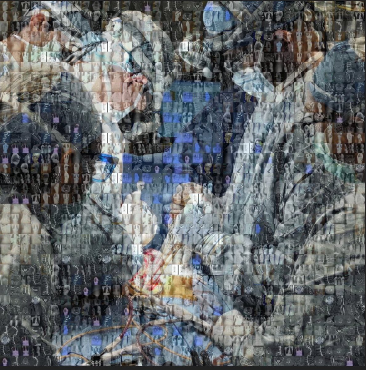AJGrossbach's tweet photo. Just did my 2,000th surgical case at The Ohio State University. Doesn’t seem too long ago I was just getting started here.  Couldn’t do any of it without such a wonderful team!  Here’s to hopefully many more! https://t.co/B0X3JTICuL