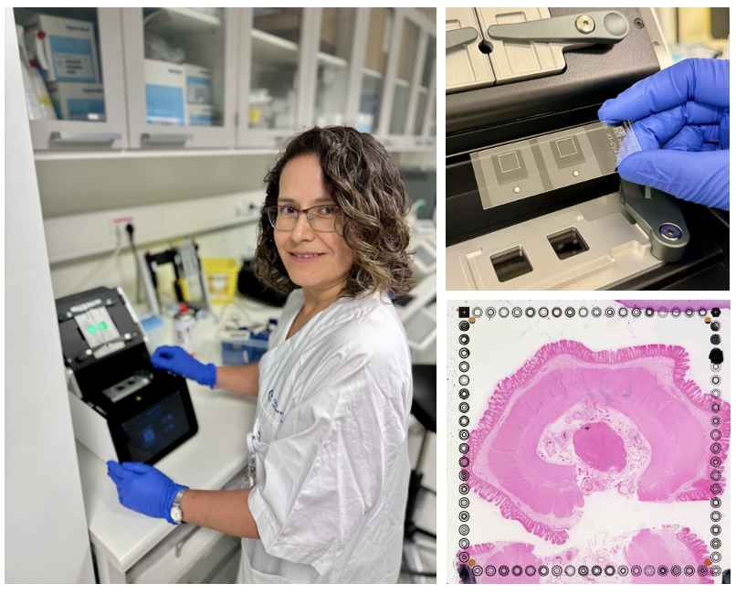OSLOmicsCore's tweet image. This is our first @10xGenomics Visium HD service at the Genomics Core Facility. We are looking forward to seeing the data. There is a high demand for this new technology to study spatial biology at single–cell–scale resolution. @OusResearch @MezaZepeda