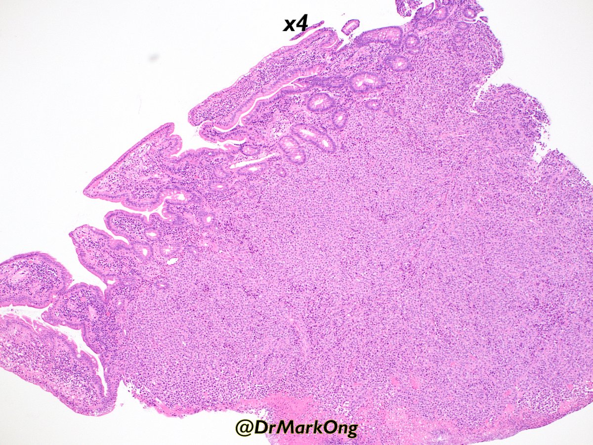 Mark Ong tweet media