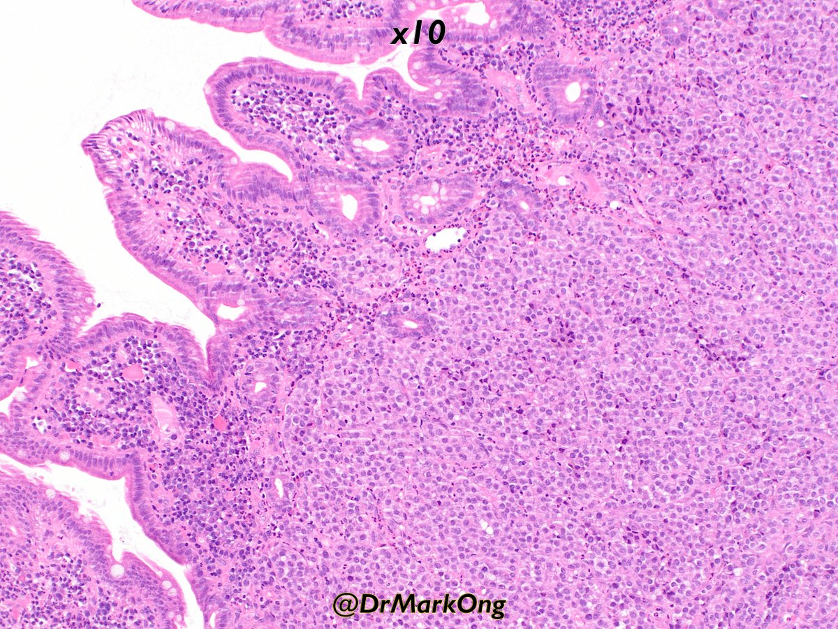 Mark Ong tweet media