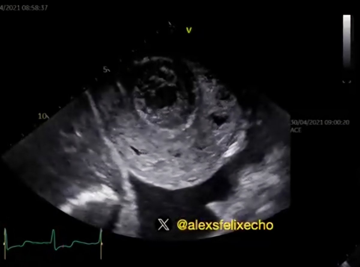 @alexsfelixecho Wow, I have never seen anything like this image!! That's very striking... #echofirst