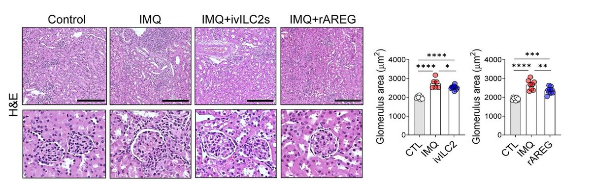 Integrin α4β7 retains ILC2 in kidney that provide the reparative cytokine amphiregulin, which can be antagonized by TLR7/9 signaling or augmented by IL-33 to modulate lupus nephritis
nature.com/articles/s4142…