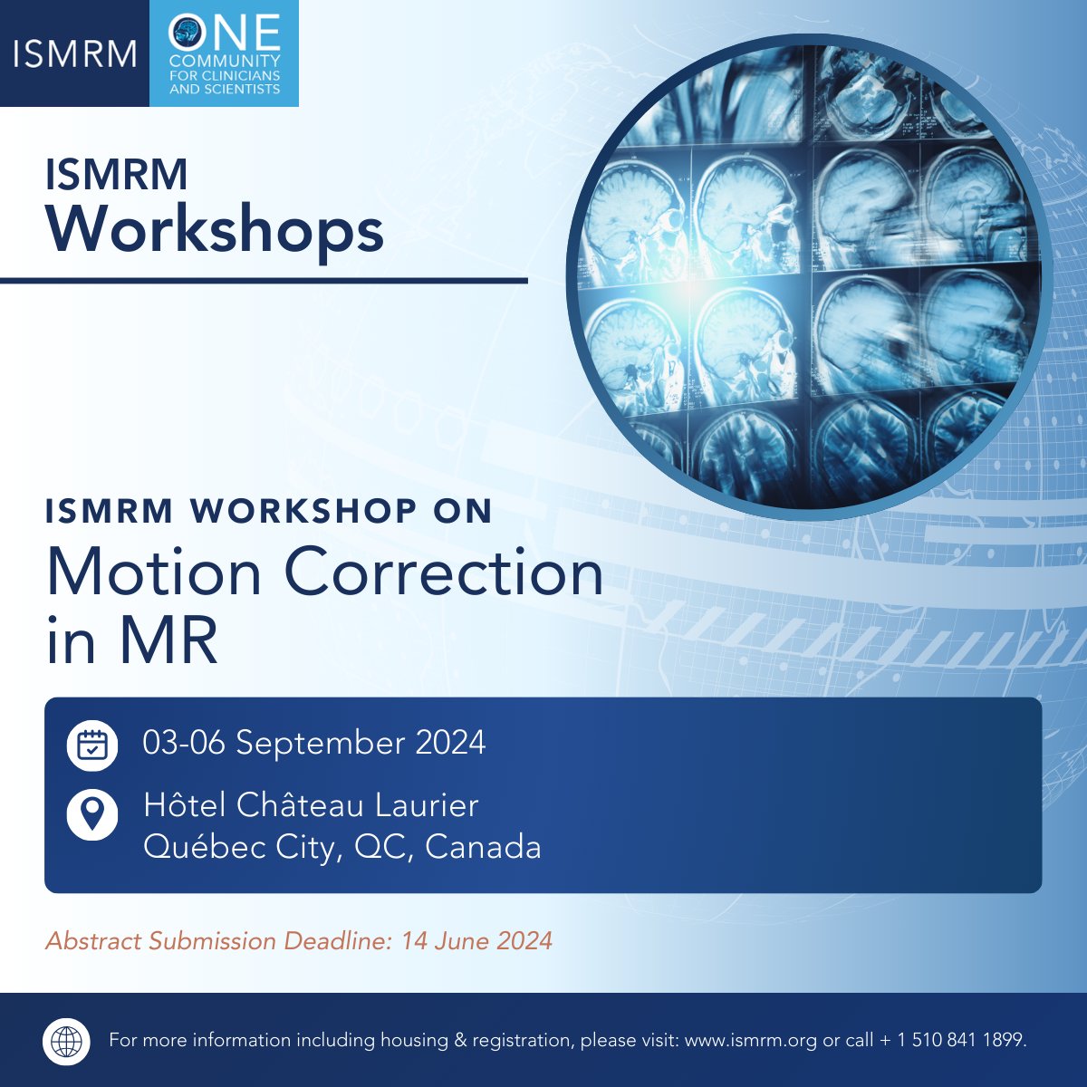 WORKSHOP WEDNESDAY: Get your abstracts ready for the next ISMRM workshop: ISMRM Workshop on Motion Correction in MR 03-06 September 2024 The abstract submission & stipend application site is now open! Learn more: ow.ly/2z3o50S16Ul #ISMRM #ISMRT #MRI #MagneticResonance