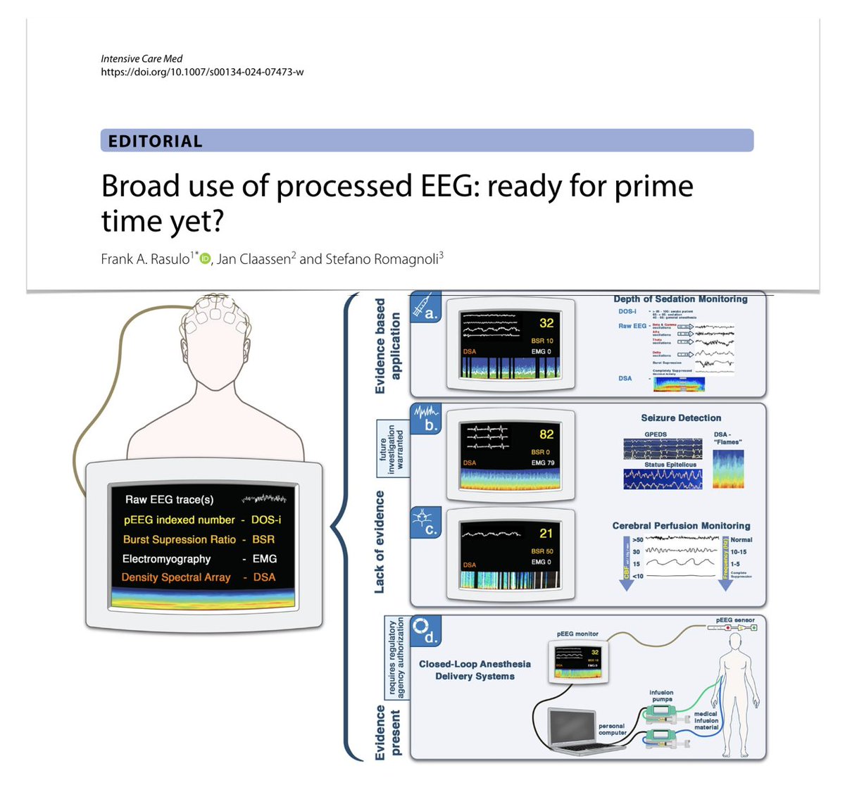 Broad use of processed EEG: ready for prime time??
🧠 anesthesia & sedation monitoring
🔮 future applications
   detection of seizure
   detection of cerebral hypoperfusion
   closed‑loop anesthesia delivery systems
⚠️ limitations
#FOAMcc on @yourICM 
🔓 rdcu.be/dJpvI