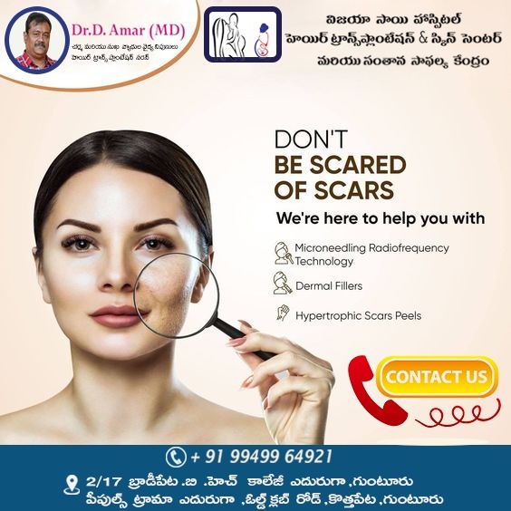 DON'T BE SCARED OF SCARS
We're here to help you
𝐅𝐨𝐫 𝐦𝐨𝐫𝐞 𝐢𝐧𝐟𝐨,
𝐂𝐚𝐥𝐥 𝐔𝐬 : +𝟗𝟏 – 099499 64921
#scared #scarstreatment #hypertrophicscars #dermalfillers #bestdoctornearme
#prptreatment # besthaircaretreatment #bestdoctors