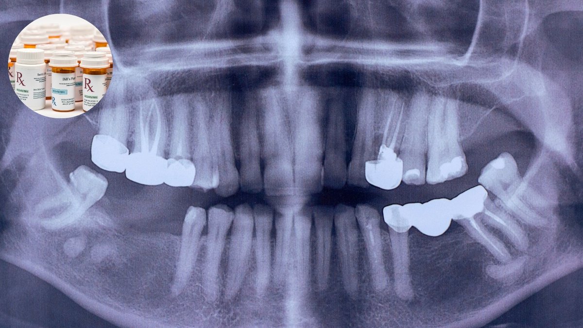 Hito científico: logran crear medicamento 💊 para regenerar los dientes caídos en adultos 👇